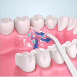 Hqd Portable Household Electric Tooth Washer Teeth Cleaning Oral Care No Harm to Teeth Dental Rechargeable Teeth Whitening