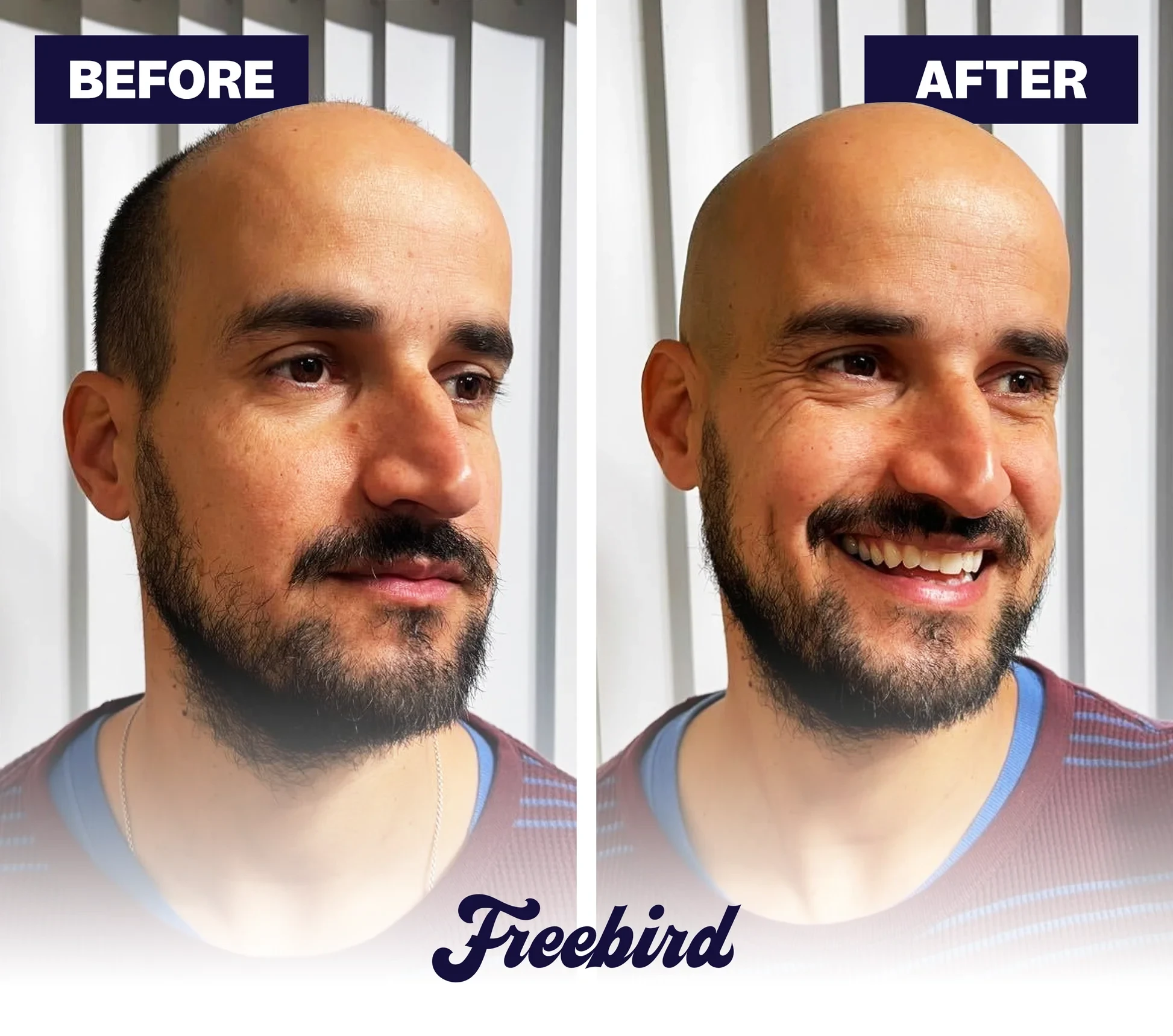 Full-Body Shaving Made Simple – Head, Face, Body & Below the Waist