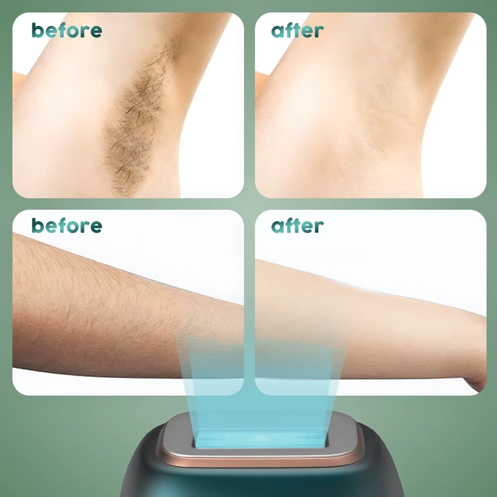 Sejoy IPL Hair Removal Device Portable Laser Epilator for Women Men with NTC Overheating Protection Auto Shut Down LCD Display