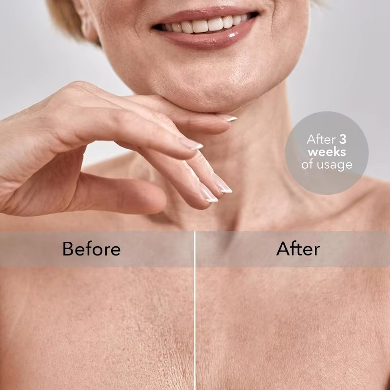 SilkRest™ Breast Support Pillow – Anti-Wrinkle Chest Pillow for Side Sleeping