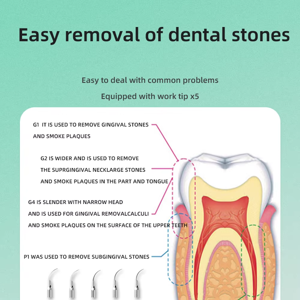 INSEX B-type ultrasonic medical dental cleaning machine, pet beauty salon, dental stone removal, dental cleaning machine